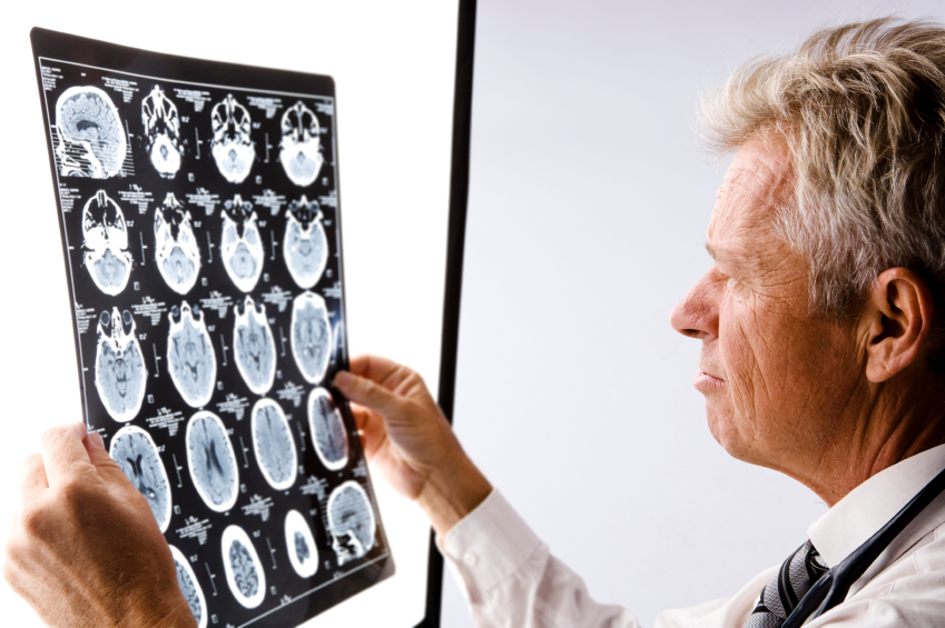 Neurologist idrocefaloidiopatico